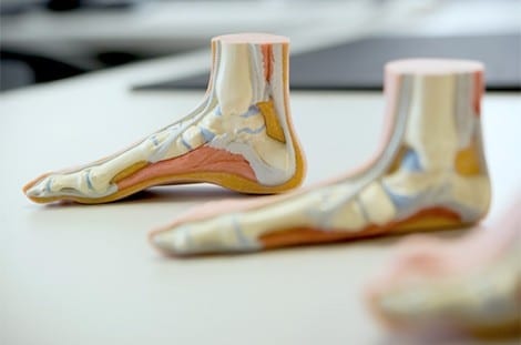 Podiatrist on the gold coast explaining why Orthotics are helpful